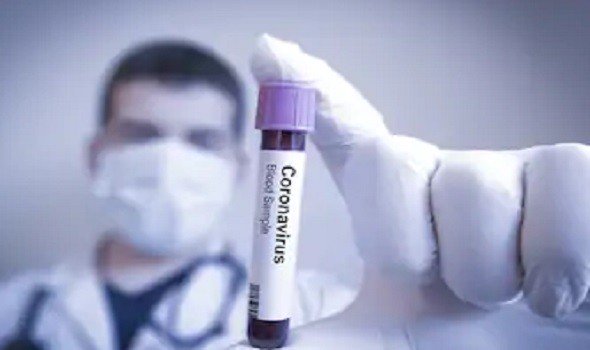 فريق علمي كوردي يعلن توصله الى علاج “فيروس كرورنا”